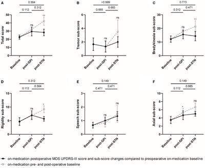 Rescue subthalamic stimulation after unsatisfactory outcome of pallidal stimulation in Parkinson's disease: a case series and review